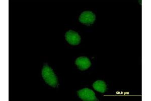 Immunofluorescence of purified MaxPab antibody to CBFA2T2 on HeLa cell. (CBFA2T2 抗体  (AA 1-575))