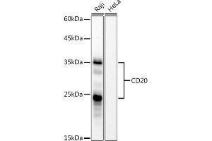 Western blot analysis of extracts of Raji cells, using CD20 antibody (ABIN7268472) at 1:1000 dilution. (CD20 抗体)