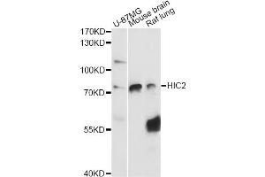 Western blot analysis of extracts of various cell lines, using HIC2 antibody (ABIN6291160) at 1:3000 dilution. (HIC2 抗体)