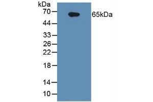 Detection of IL1R1 in Human Raji Cells using Polyclonal Antibody to Interleukin 1 Receptor Type I (IL1R1) (IL1R1 抗体  (AA 21-109))