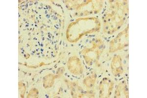 Immunohistochemistry (IHC) image for anti-Protein Kinase, AMP-Activated, alpha 2 Catalytic Subunit (PRKAA2) (AA 350-400), (Catalytic Subunit alpha) antibody (ABIN7142660)