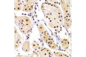 Immunohistochemistry of paraffin-embedded human gastric injury using HNRNPA1 Antibody (ABIN5975570) at dilution of 1/100 (40x lens). (HNRNPA1 抗体)