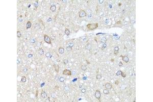 Immunohistochemistry of paraffin-embedded Rat brain using PRKAG1 Polyclonal Antibody at dilution of 1:100 (40x lens). (PRKAG1 抗体)