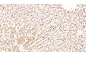 Detection of C5a in Rat Liver Tissue using Polyclonal Antibody to Complement Component 5a (C5a) (C5A 抗体  (AA 1-77))