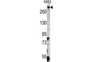 Western Blotting (WB) image for anti-Pericentriolar Material 1 (PCM1) antibody (ABIN3003241) (PCM1 抗体)