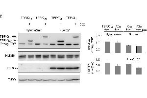 ROS and HMGB1 distribution in TBP/Q36~79 293 cells. (Histone H3.3B 抗体  (full length))