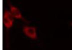 ABIN6268882 staining HeLa cells by IF/ICC. (Fibronectin 1 抗体  (C-Term))