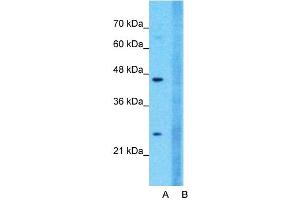 Host:  Rabbit  Target Name:  CLDN18  Sample Type:  Jurkat  Lane A:  Primary Antibody  Lane B:  Primary Antibody + Blocking Peptide  Primary Antibody Concentration:  1ug/ml  Peptide Concentration:  5ug/ml  Lysate Quantity:  25ug/lane/lane  Gel Concentration:  0. (Claudin 18 抗体  (C-Term))