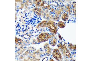 Immunohistochemistry of paraffin-embedded Mouse kidney using PYCR2 Rabbit pAb (ABIN7269766) at dilution of 1:100 (40x lens). (PYCR2 抗体  (AA 271-320))