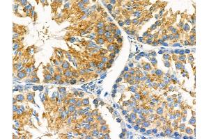 ABIN6259308 and ABIN6275426 at 1/100 staining Mouse testis tissue by IHC-P. (MOV10L1 抗体  (Internal Region))