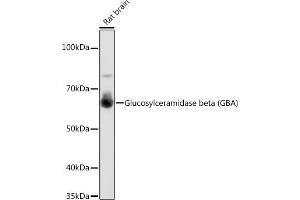 Western blot analysis of extracts of Rat brain, using Glucosylceramidase beta (Glucosylceramidase beta (GBA)) antibody (ABIN7267407) at 1:1000 dilution. (GBA 抗体)