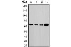 Western blot analysis of Melanophilin expression in MCF7 (A), HT29 (B), mouse lung (C), rat lung (D) whole cell lysates. (Melanophilin 抗体)