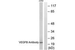 Western blot analysis of extracts from Jurkat cells, using VEGFB Antibody. (VEGFB 抗体  (AA 91-140))