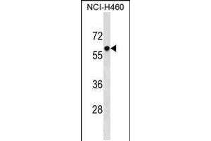 Western blot analysis in NCI-H460 cell line lysates (35ug/lane). (PRIM2 抗体  (AA 317-345))