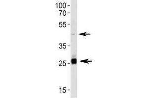 Western Blotting (WB) image for anti-Sirtuin 3 (SIRT3) (AA 250-279) antibody (ABIN3032590)