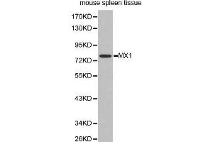Western Blotting (WB) image for anti-Myxovirus Resistance Protein 1 (MX1) (AA 368-662) antibody (ABIN3022533) (MX1 抗体  (AA 368-662))