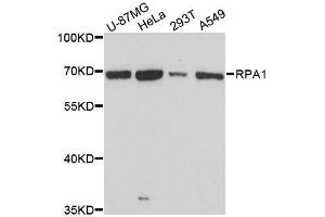 Western blot analysis of extracts of various cell lines, using RPA1 antibody. (RPA1 抗体  (AA 1-240))