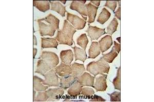 Immunohistochemistry (Paraffin-embedded Sections) (IHC (p)) image for anti-Adaptor Related Protein Complex 1 sigma 1 (AP1S1) (AA 5-34), (N-Term) antibody (ABIN651199)