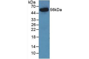 Detection of Recombinant AGT, Rat using Monoclonal Antibody to Angiotensinogen (AGT) (AGT 抗体  (AA 25-477))