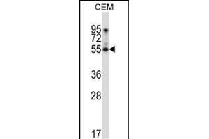 LMD Antibody (N-term) (ABIN657125 and ABIN2846269) western blot analysis in CEM cell line lysates (35 μg/lane). (PALMD 抗体  (N-Term))