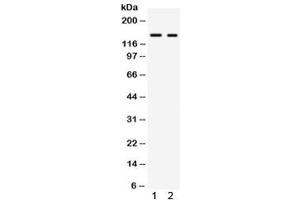 Western blot testing of 1) rat liver and 2) mouse liver lysate with RIP140 antibody.