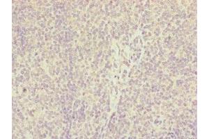 Immunohistochemistry of paraffin-embedded human tonsil tissue using ABIN7156903 at dilution of 1:100 (IL36A/IL1F6 抗体  (AA 1-158))