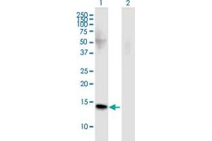 Western Blot analysis of FMN2 expression in transfected 293T cell line by FMN2 monoclonal antibody (M02), clone 4B8. (Formin 2 抗体  (AA 144-243))