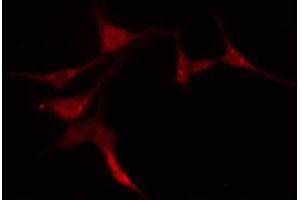 ABIN6274200 staining COLO205 cells by IF/ICC. (PRKACG 抗体)