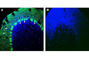 Expression of SLIT1 in mouse cerebellum.