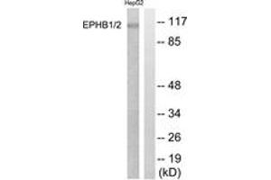 Western blot analysis of extracts from HepG2 cells, using EPHB1/2 (Ab-594/604) Antibody. (EPHB1/2 抗体  (AA 561-610))