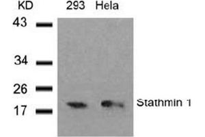 Image no. 3 for anti-Stathmin 1 (STMN1) (Ser37) antibody (ABIN197456) (Stathmin 1 抗体  (Ser37))
