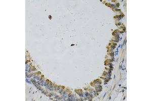 Immunohistochemistry of paraffin-embedded mouse lung using EFNA1 Antibody (ABIN5973078) at dilution of 1/100 (40x lens). (Ephrin A1 抗体)