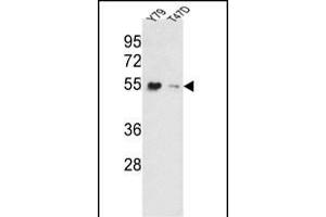 Western blot analysis of EEF1A1/ EEF1A2 Antibody (N-term) (ABIN390520 and ABIN2840872) in Y79, T47D cell line lysates (35 μg/lane). (EEF1A2 抗体  (AA 46-72))
