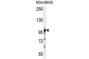 AXIN1 Antibody (C-term) western blot analysis in MDA-MB435 cell line lysates (35µg/lane). (Axin 抗体  (C-Term))