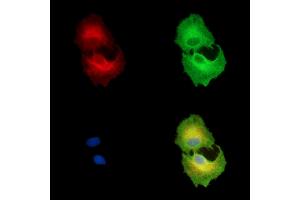 ABIN7096540 and ABIN7100604 staining  cells by IF/ICC.