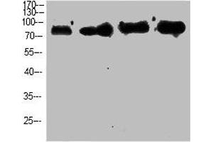 Western Blot analysis of customer's using p63 Polyclonal Antibody. (p63 抗体  (N-Term))