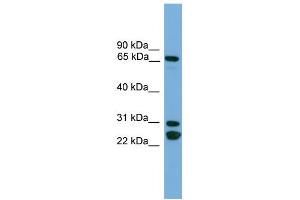 WB Suggested Anti-DNAI2  Antibody Titration: 0. (DNAI2 抗体  (N-Term))