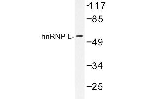 Image no. 1 for anti-Heterogeneous Nuclear Ribonucleoprotein L (HNRNPL) antibody (ABIN272168) (HNRNPL 抗体)