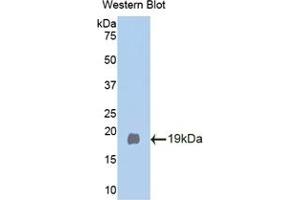 Detection of Recombinant Klb, Mouse using Polyclonal Antibody to Klotho Beta (KLb) (Klotho beta 抗体  (AA 380-506))