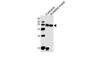All lanes : Anti-DLK1 Antibody (C-term) at 1:1000 dilution Lane 1: human placenta lysates Lane 2: mouse skeletal muscle lysates Lysates/proteins at 20 μg per lane. (DLK1 抗体  (C-Term))