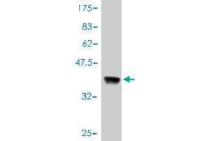 Western Blot detection against Immunogen (37. (ErbB2/Her2 抗体  (AA 22-121))