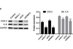 DNM1L deficiency in FLSs reduces their viability and production of pro-inflammatory cytokines, and increases apoptosis. (IL-8 抗体  (AA 21-99))