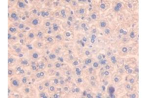 Immunohistochemistry (IHC) image for anti-Activating Transcription Factor 7 (ATF7) (AA 50-270) antibody (ABIN7441865)