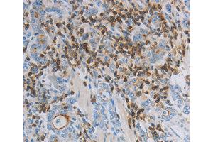 Immunohistochemistry (IHC) image for anti-Par-6 Partitioning Defective 6 Homolog alpha (PARD6A) antibody (ABIN1874031) (PARD6A 抗体)