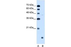 WB Suggested Anti-EDG8 Antibody Titration:  0. (S1PR5 抗体  (N-Term))