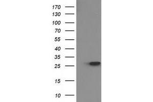 Western Blotting (WB) image for anti-Hydroxyprostaglandin Dehydrogenase 15-(NAD) (HPGD) antibody (ABIN1496362) (HPGD 抗体)