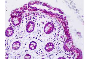 Anti-MNSOD / SOD2 antibody IHC staining of human colon.