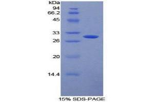 SDS-PAGE (SDS) image for Fc gamma RII (CD32) (AA 69-309) protein (His tag,T7 tag) (ABIN1879164)