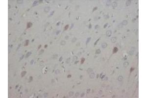 Immunohistochemical analysis of paraffin embedded rat tissue sections (brain) using NT3 antibody (Neurotrophin 3 抗体  (Middle Region))