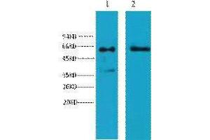 Western Blotting (WB) image for anti-Keratin 6 (KRT6) antibody (ABIN3178633) (Keratin 6 抗体)